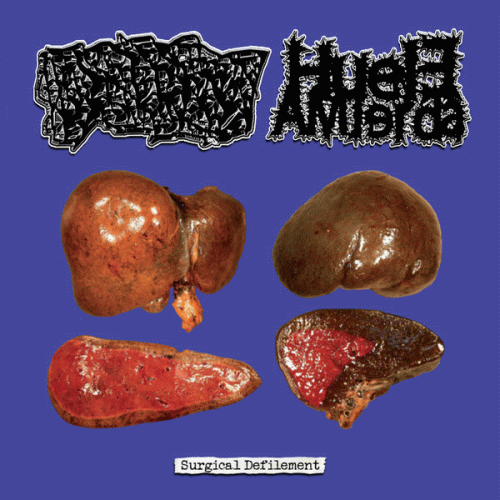 Benzoylmethylecgonine : Surgical Defilement